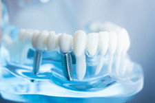 Dentatec Dentaltechnik GmbH  
